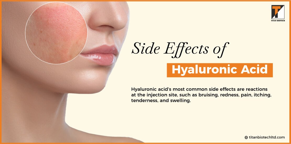 Side Effects of Hyaluronic Acid